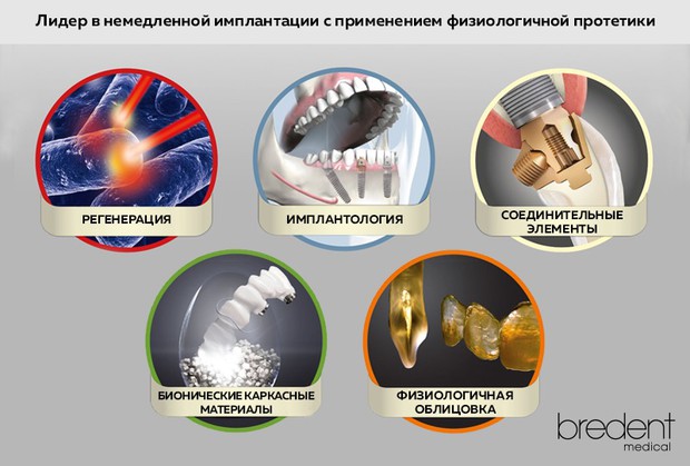 Импланты Bredent Томск Источный Лечение зубов Томск Невская